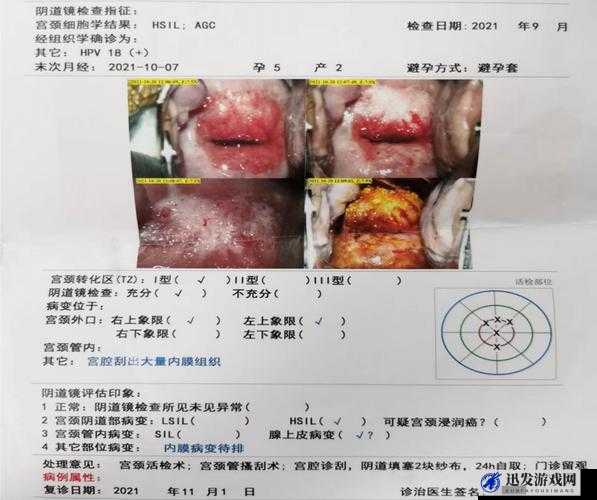 春雨医生：专业解答你的健康问题