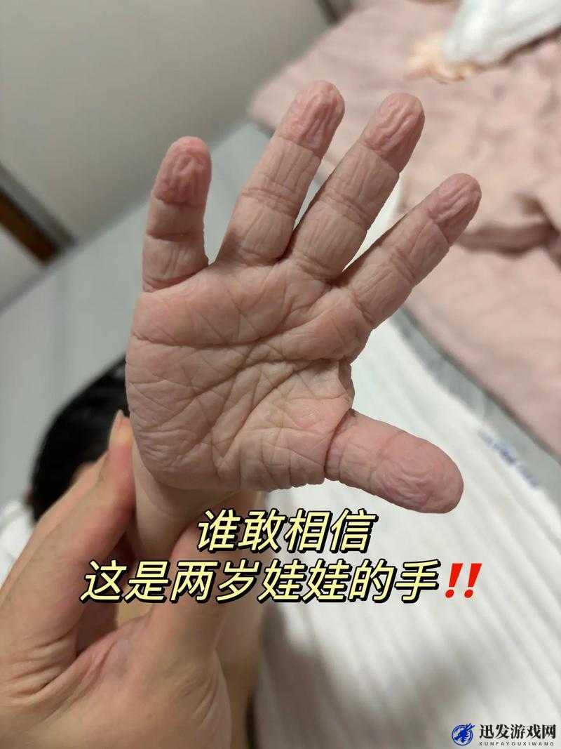 宝宝才两岁手指就已难以承受啦